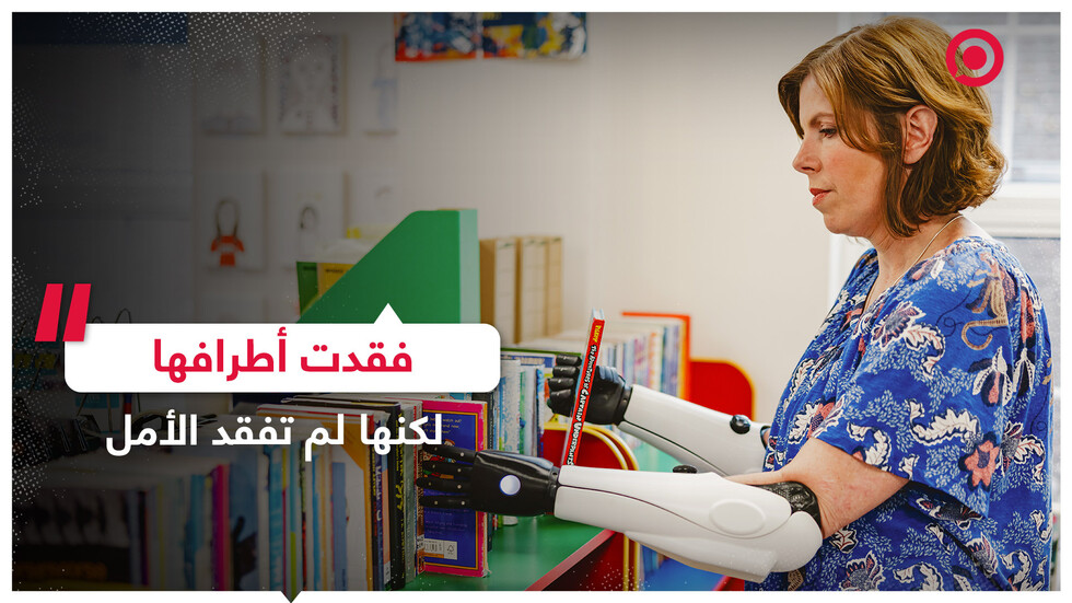 فقدت أطرافها لكنها لم تفقد الأمل