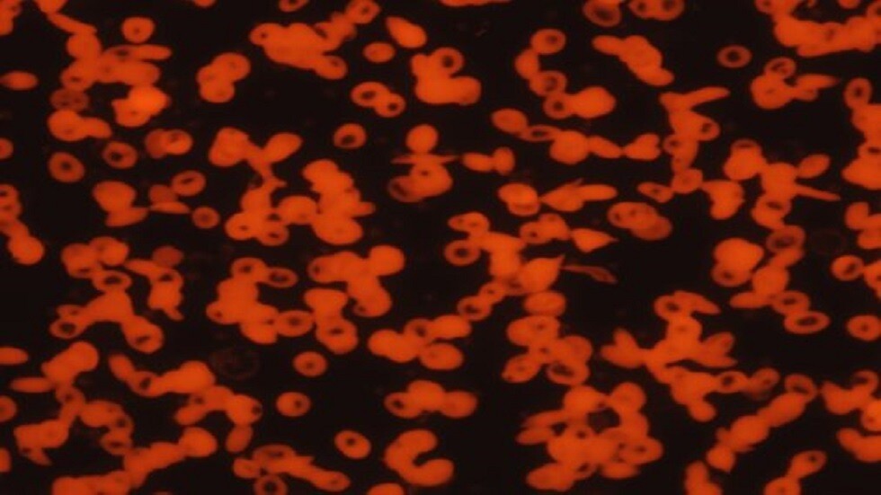 مواد غذائية لزيادة الهيموغلوبين