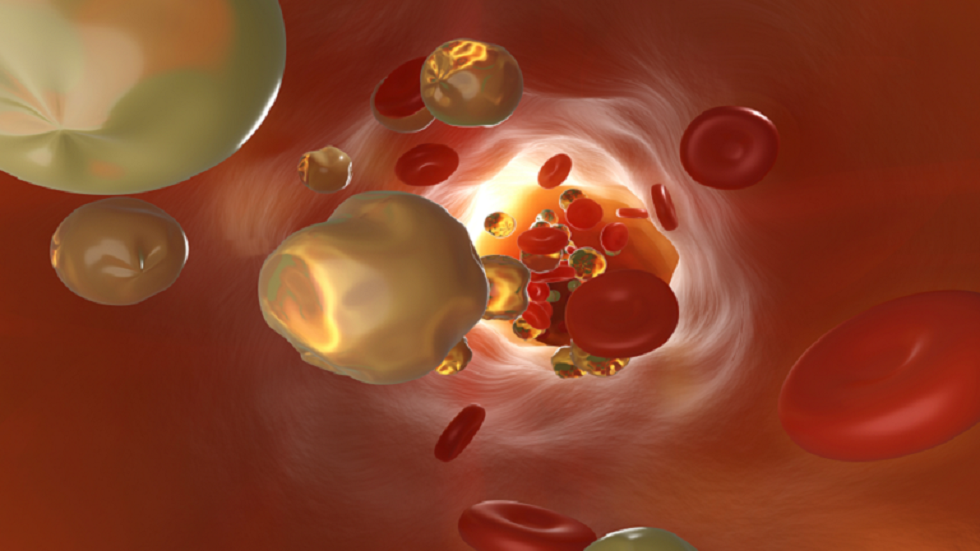 العلامات الأربع لارتفاع نسبة الكوليسترول في الدم!