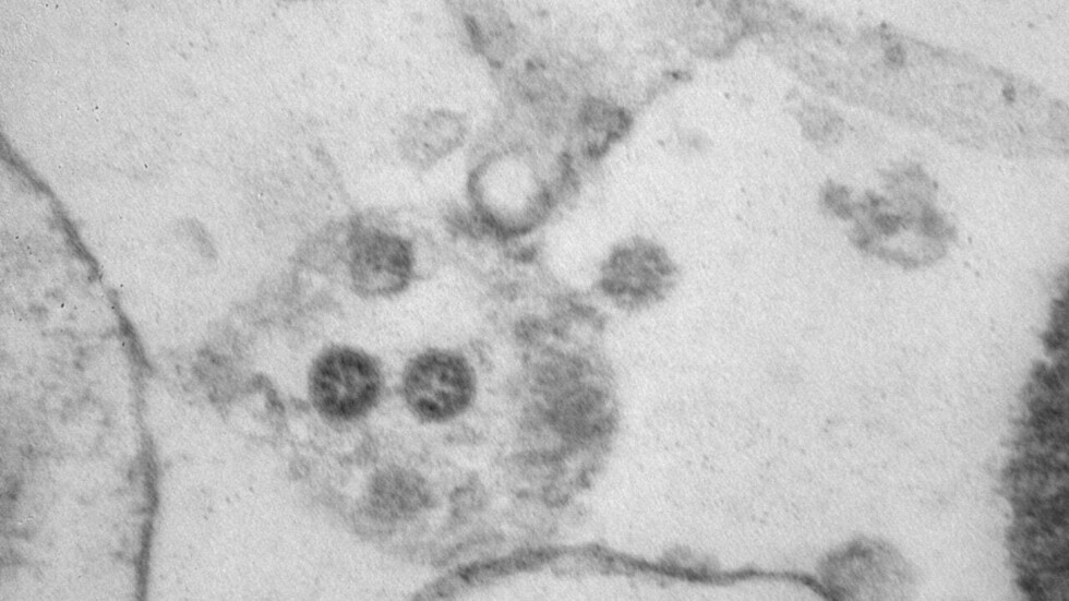 الصحة الأردنية: تسجيل ما مجموعه 1321 إصابة بـ متحور