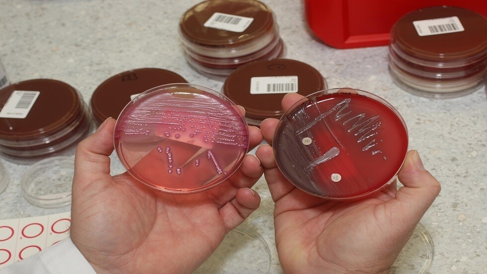 اكتشاف بكتيريا في الأمعاء تؤثر في تراكم السموم في الدم