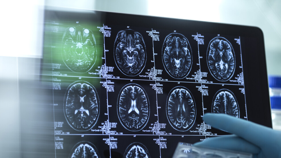 عنصر غذائي صحي شائع الاستخدام قد يعزز تدهور الدماغ و