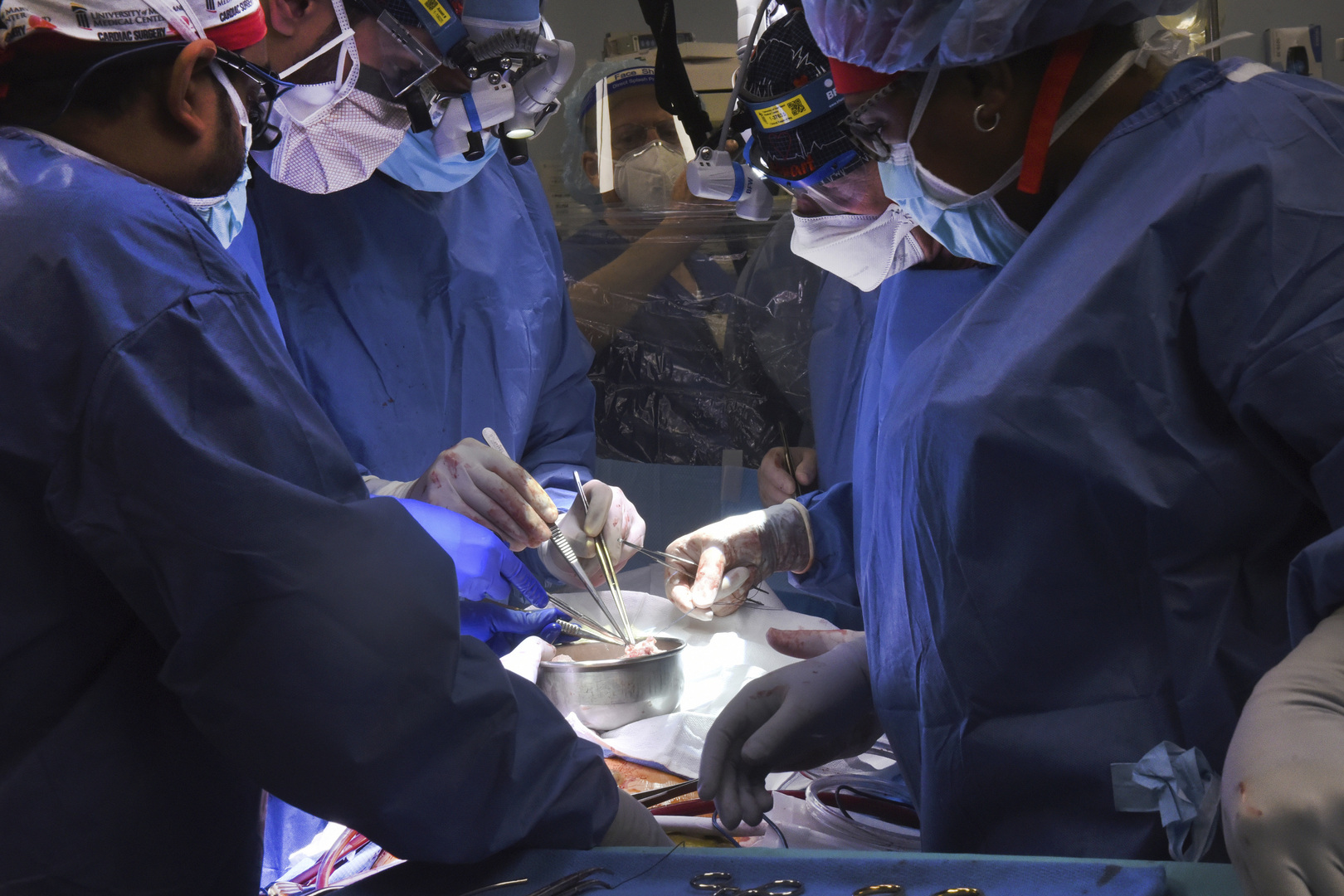 جراحون أمريكيون يزرعون بنجاح قلب خنزير في جسم إنسان في أول عملية من نوعها