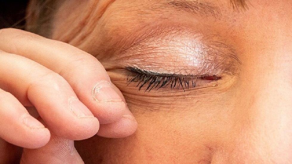 عالمة بريطانية: التهاب ملتحمة العين ربما أحد أعراض متحور 