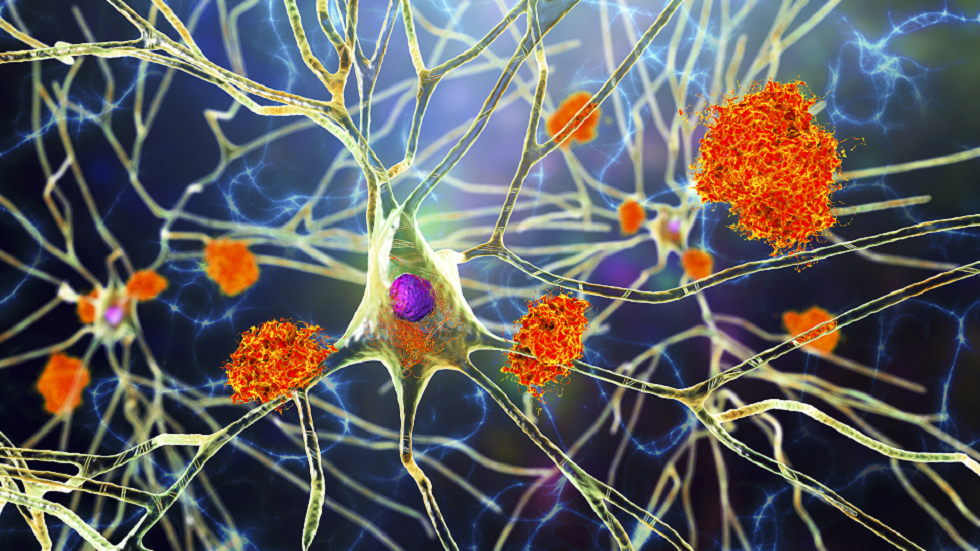 اختراق في مجال الخرف: نظام غذائي أظهر أنه يقلل من خطر الإصابة بالمرض بنسبة مذهلة!