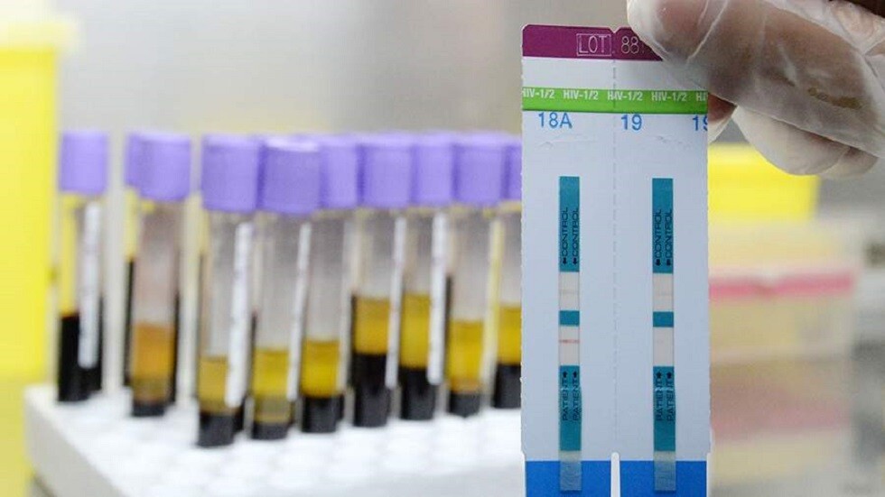 هولندا.. اكتشاف سلالة شديدة العدوى من فيروس نقص المناعة البشرية