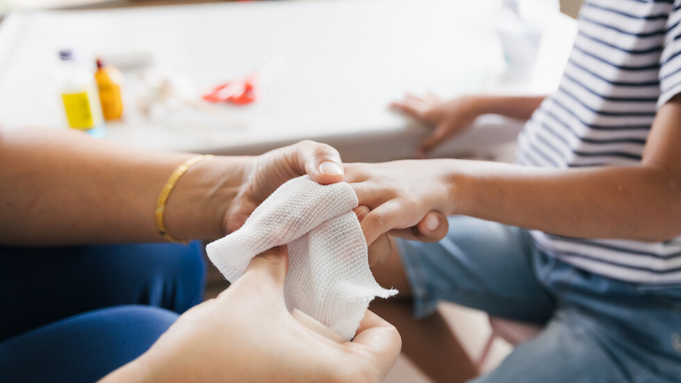 دراسة تكشف كيف يمكن للحروق - حتى البسيطة منها - أن