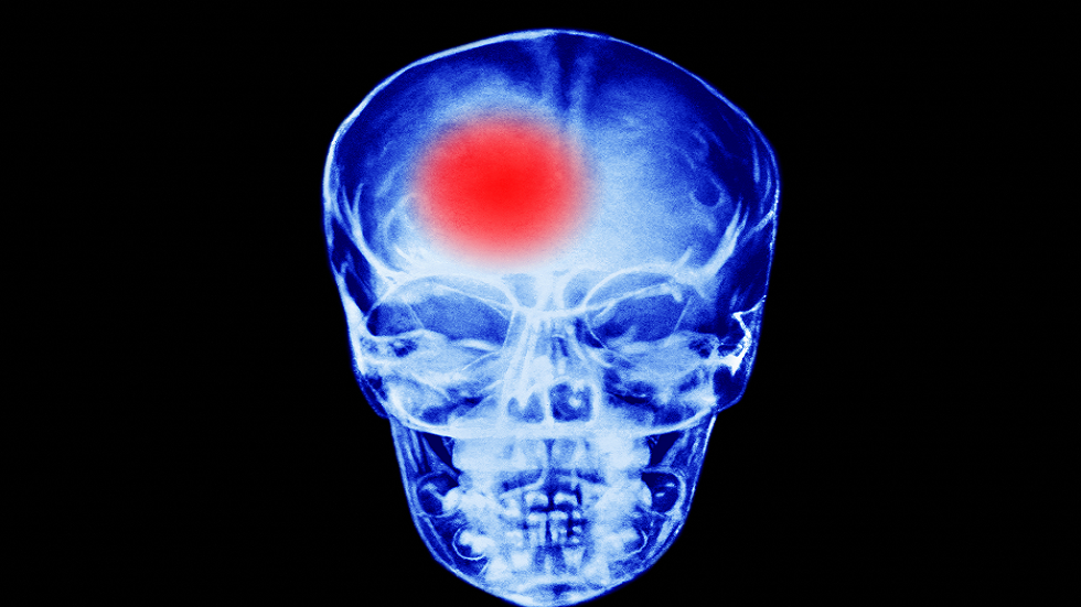 مشروب يمكن أن يزيد من خطر الإصابة بسكتة دماغية 