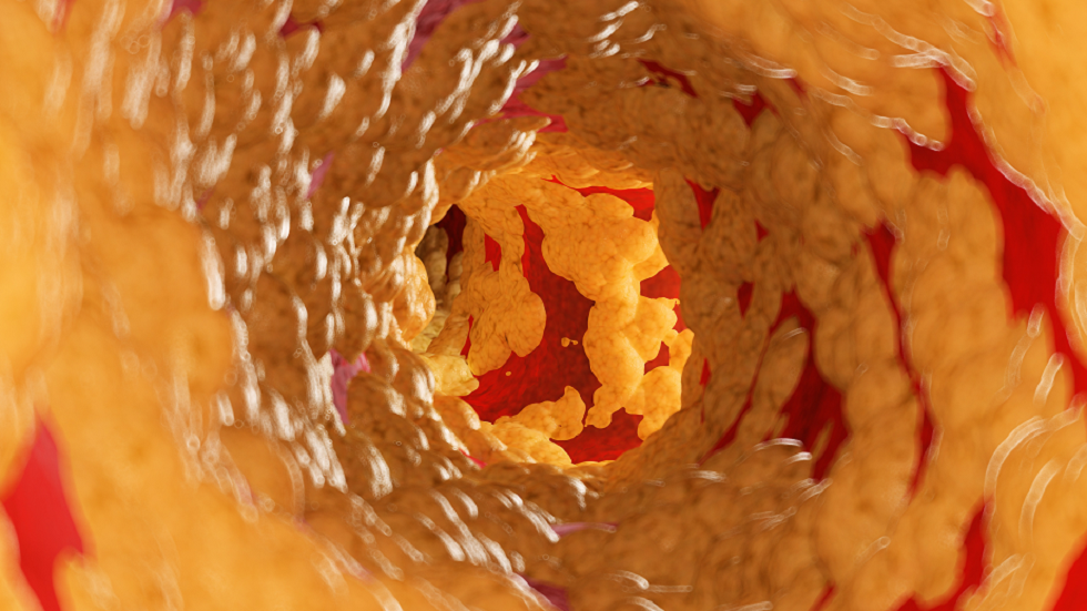 إحساس في معدتك يحذر من ارتفاع مستويات الكوليسترول بشكل خطير!