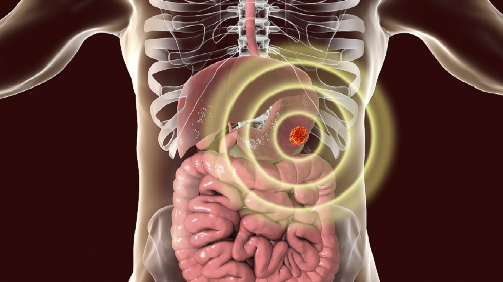 باحثون: خضار ترتبط "بارتفاع" خطر الإصابة بسرطان المعدة!