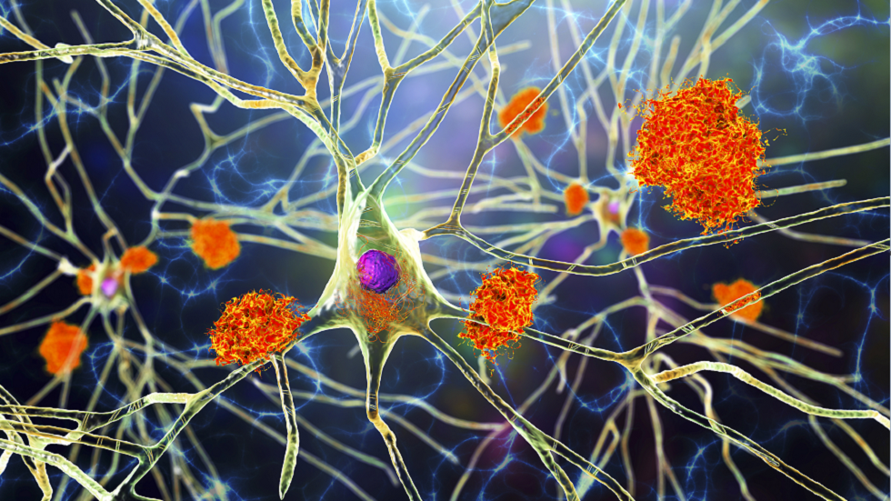 دراسة تكشف كيف يمكن عكس العلامات المبكرة للخرف!