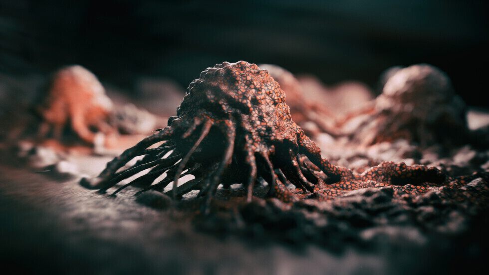 دراسة تكشف عاملا مفاجئا قد يزيد من خطر الإصابة بسرطان القولون والمستقيم