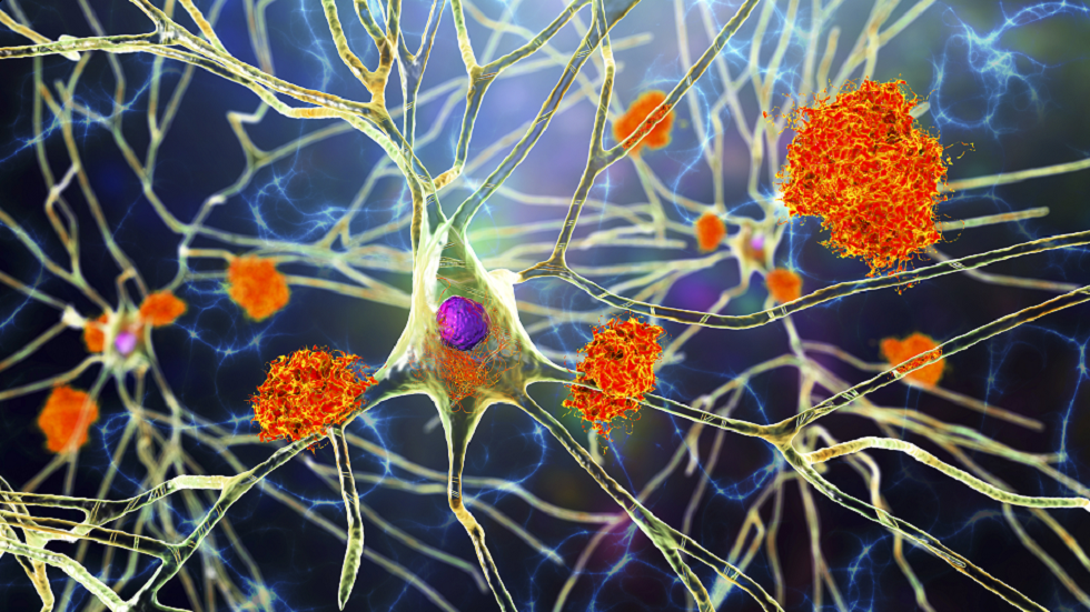 الخرف: أنماط النوم 