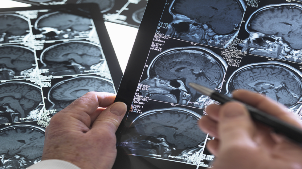 الكشف عن أنفاق "سرية" تربط الجمجمة والدماغ!