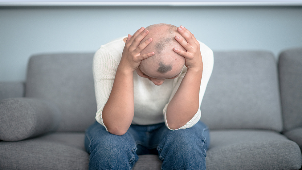 دواء شائع لالتهاب المفاصل يقدم أملا جديدا لعلاج الثعلبة الشديدة!