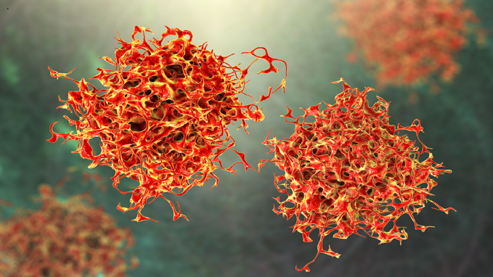 كيف يغير تلوث الهواء أنسجة الرئة ويزيد من قابلية الإصابة بالسرطان