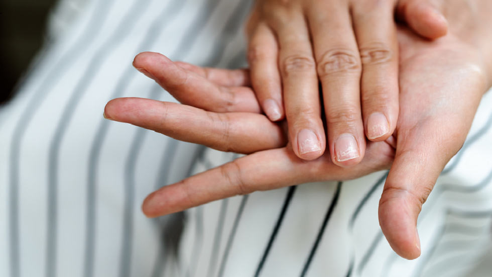 لون أظافرك قد يكشف ارتفاع نسبة الكوليسترول لديك!