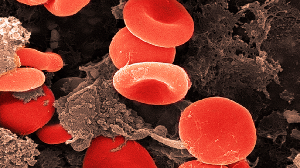 علماء روسيا يبتكرون روبوتا مرنا لعلاج تجلط الدم