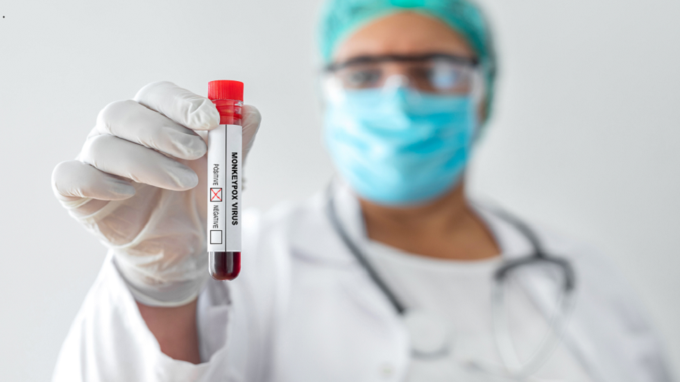 بحث جديد يحقق استنتاجات حول متحوّر جدري القردة المسؤول عن تفشي المرض مؤخرا!