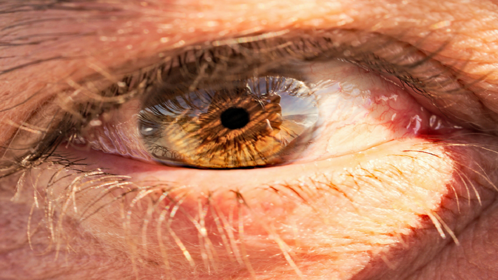 علامات في رؤيتك قد تدل على سرطان العين يجب فحصها 