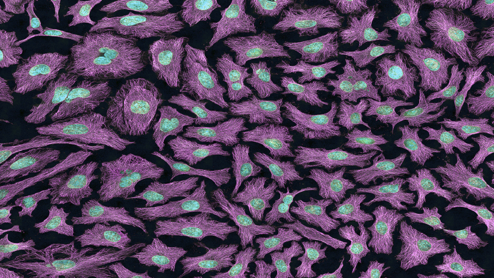 ما هي خلايا 