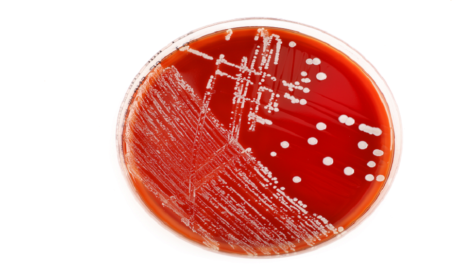 العثور على أكبر بكتيريا "لا تشبه أي شيء رأيناه سابقا"!