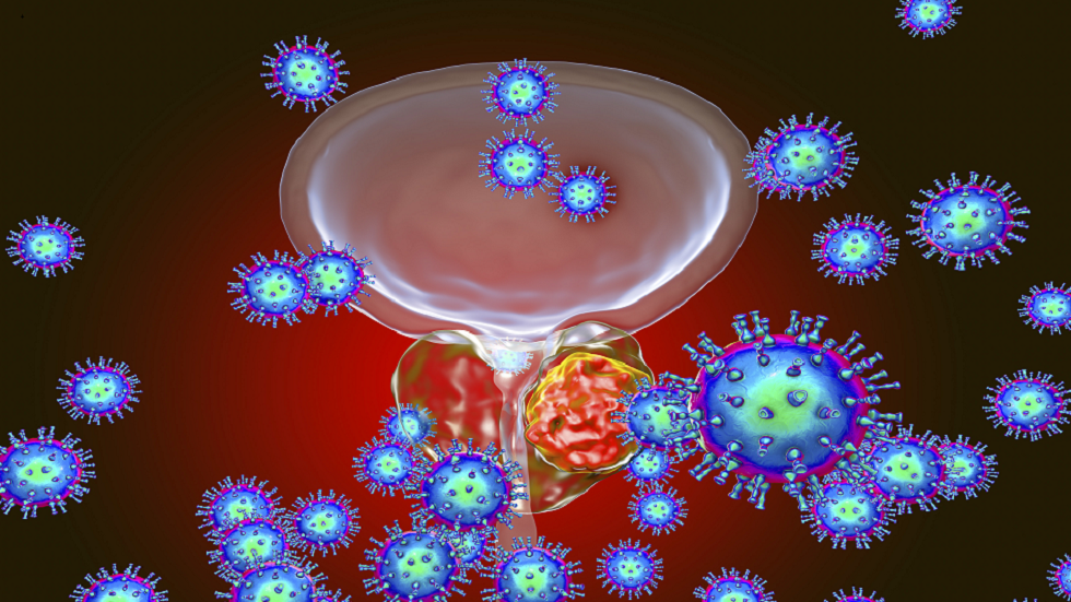 سرطان البروستات: 10 أعراض للورم المتنامي!