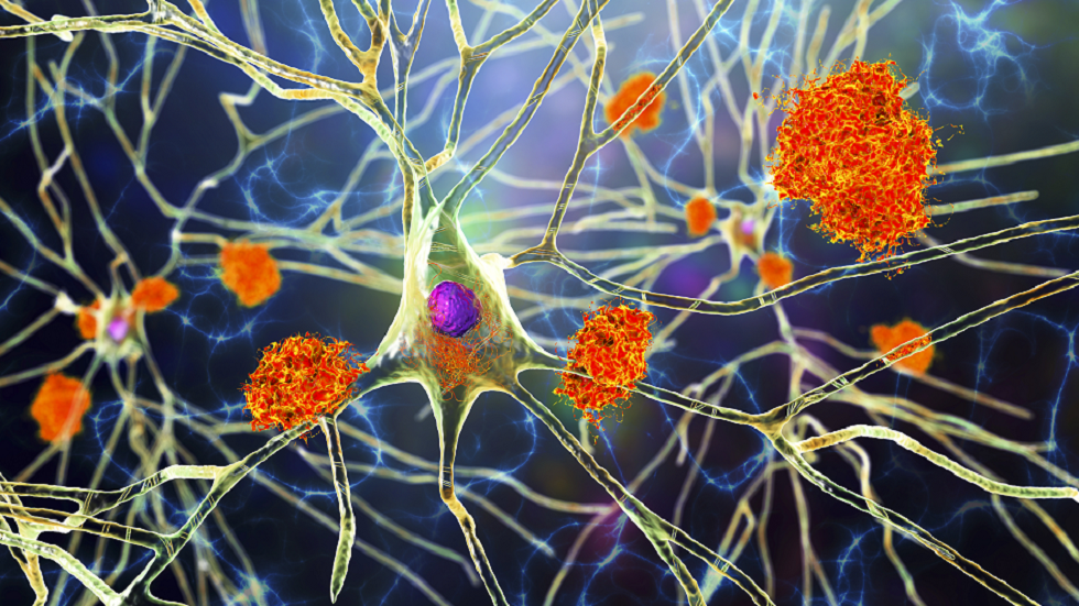 تحذير من الخرف.. طعام شائع قد 