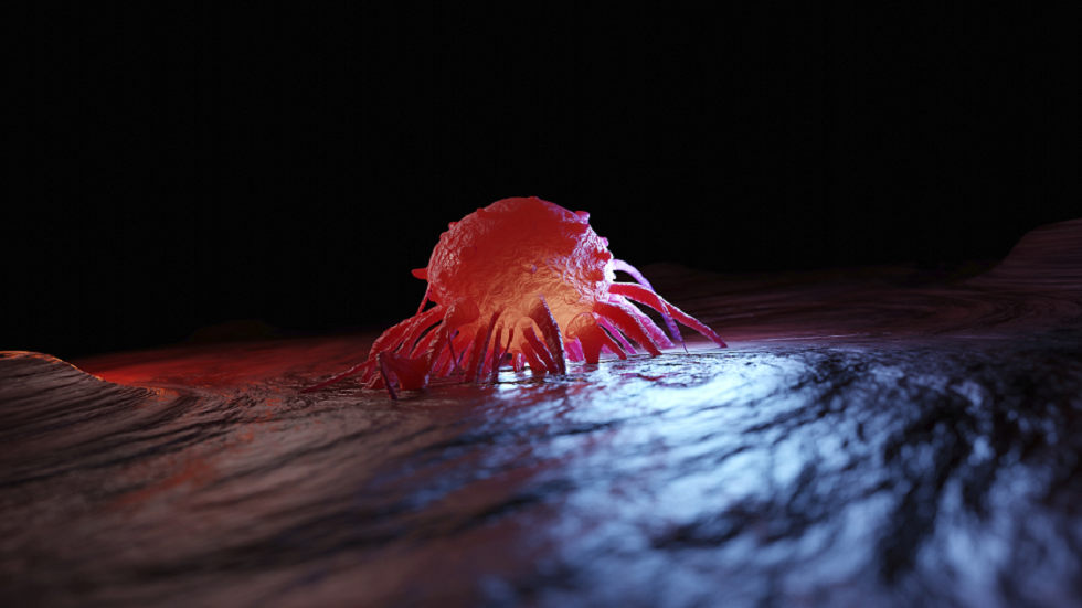 علامة على الوجه قد تدل على ورم في المعدة