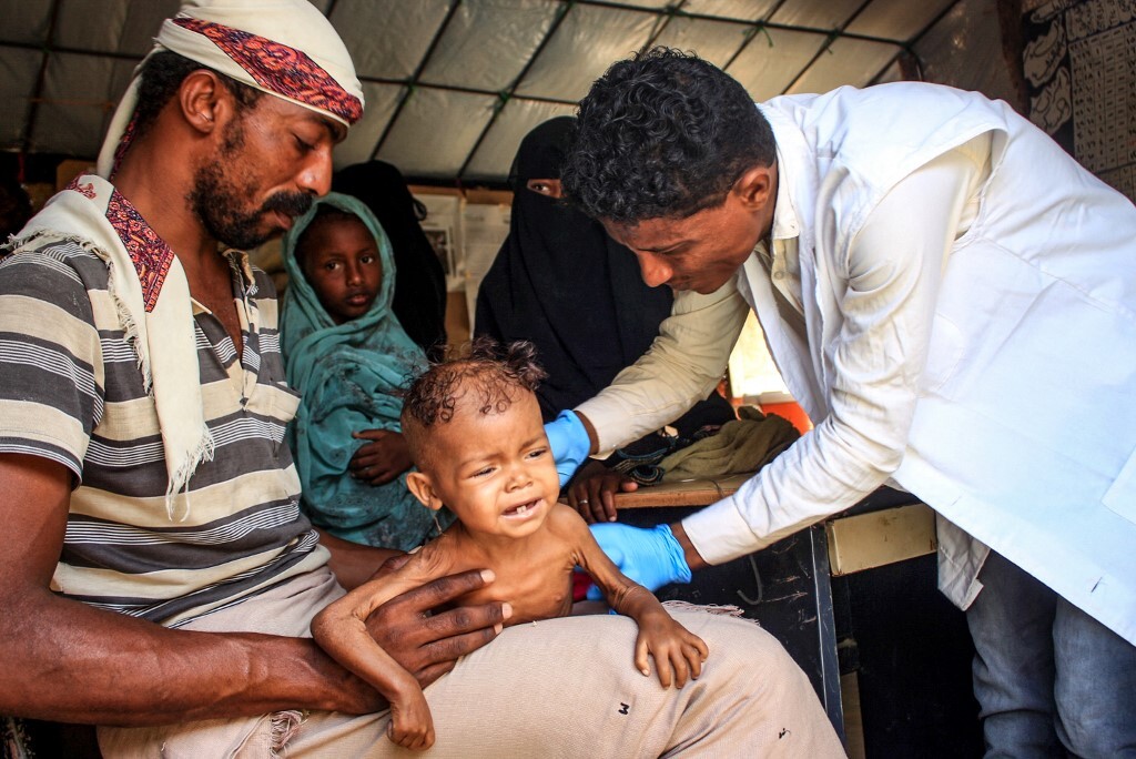 منظمة إغاثية: الأطفال اليمنيون ما زالوا يموتون من الجوع