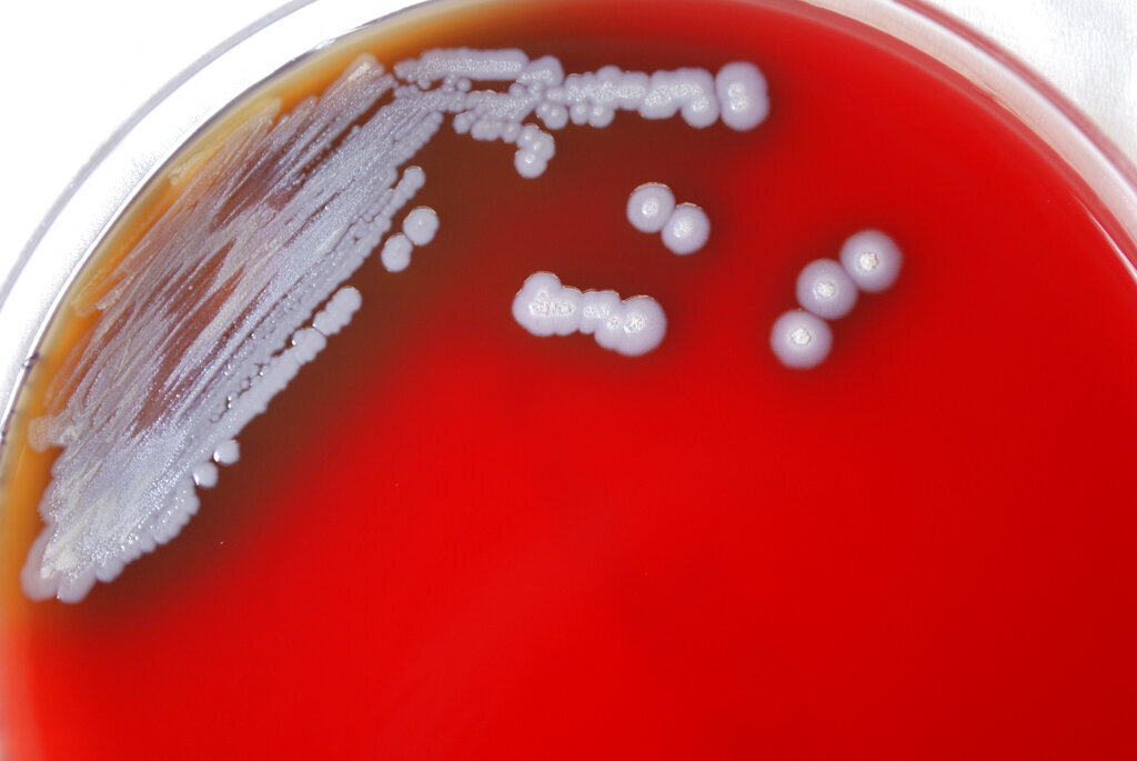المراكز الأمريكية للسيطرة على الأمراض تعلن العثور على بكتيريا قاتلة في البلاد