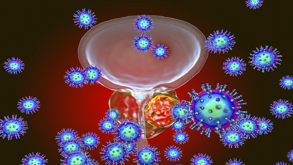 لماذا علامات سرطان البروستات المبكرة ليست واضحة كما يعتقد الرجال؟