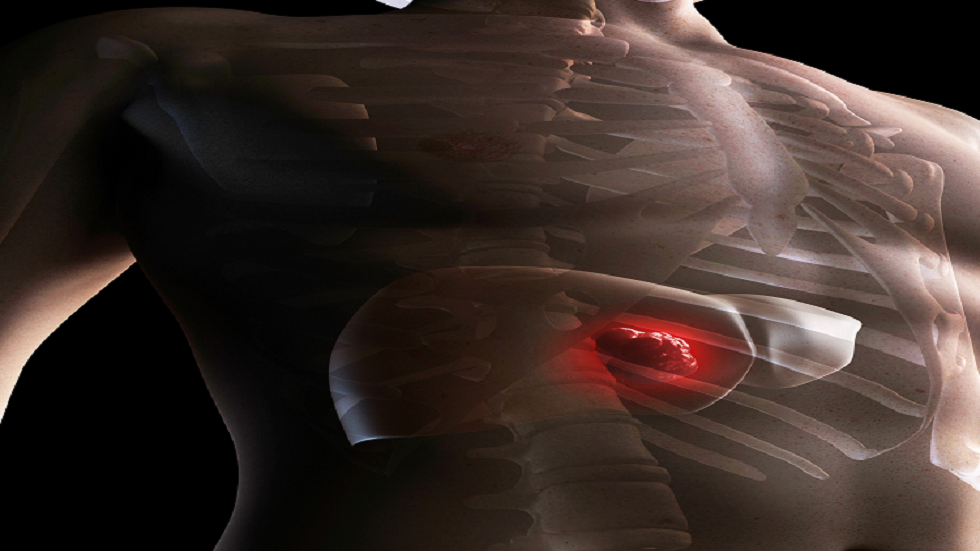 مادة كيميائية شائعة 