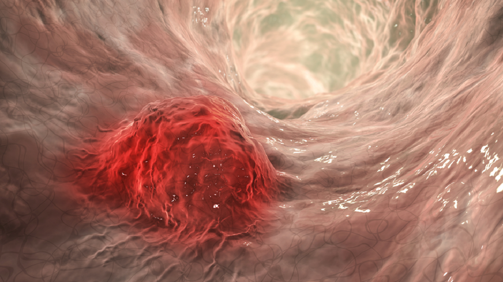 شاي عشبي مشهور قد يكون مرتبطا بزيادة خطر الإصابة بالسرطان!