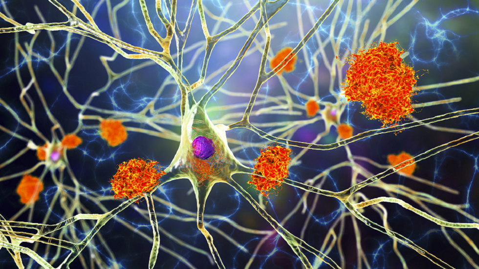 الكشف عن أدلة جديدة على أن فيروسين شائعين قد يندمجان لإحداث مرض الزهايمر!