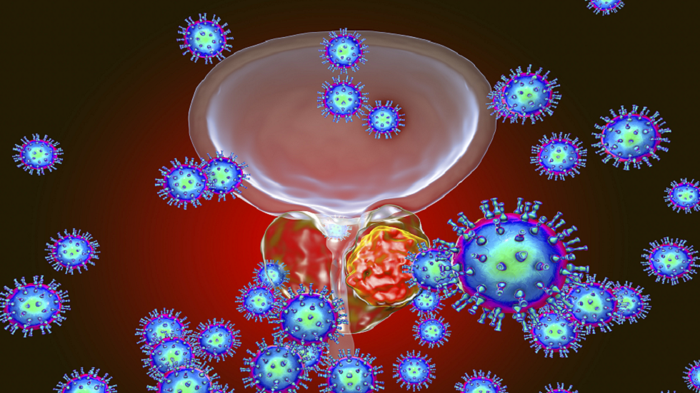عامل قد يساعد على اكتشاف سرطان البروستات مبكرا