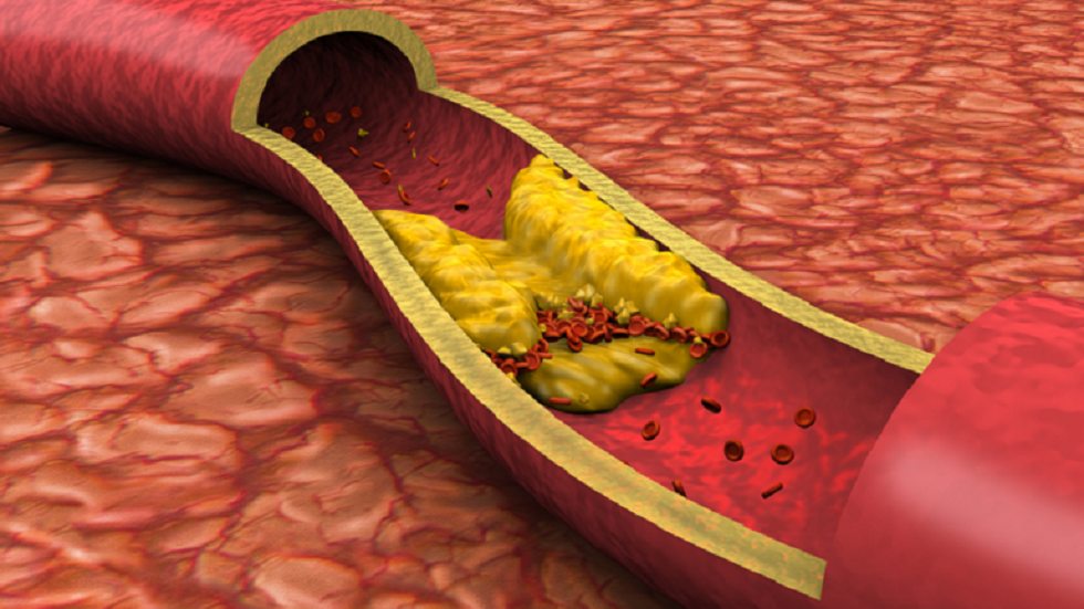 كيف نخفّض مستوى الكوليسترول في الدم؟