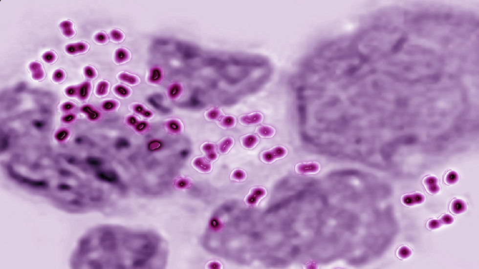 بكتيريا مجهرية "تنزلق" حول فمك لتعيش في "ضيافته"!