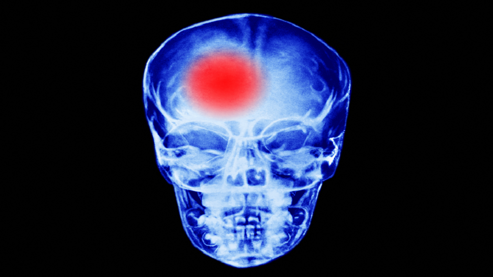 دراسة تكشف عن مشروب مفاجئ قد يرتبط بـ 