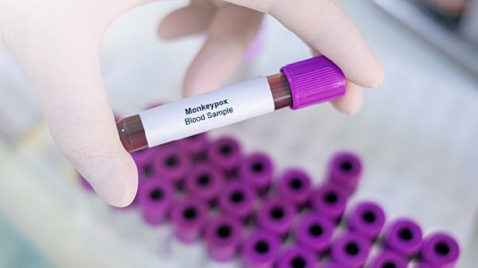 الولايات المتحدة.. إصابة 30 طفلا على الأقل بجدري القردة