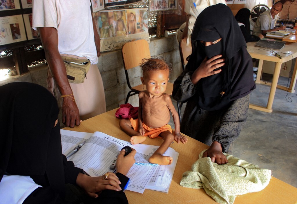 تحذيرات أممية جديدة من تفاقم احتياجات ومعاناة اليمنيين في ظل نقص تمويل المساعدات