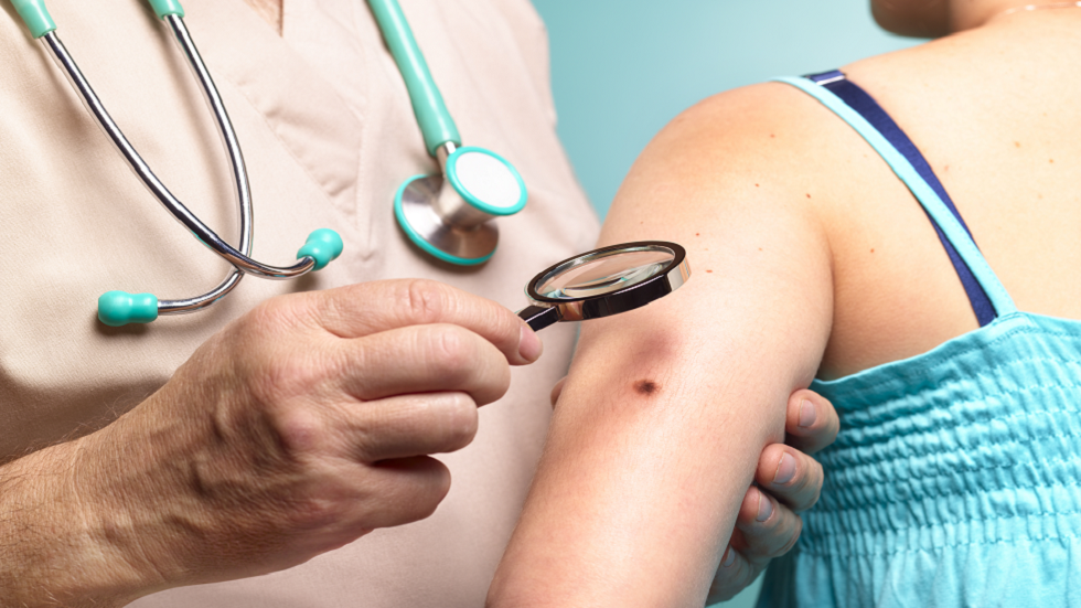 اكتشاف طريقة توقف نمو أخطر أنواع سرطان الجلد ما يبشر بعلاجات جديدة