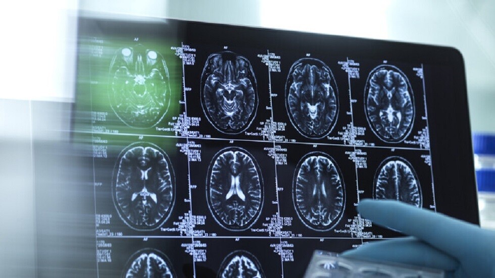 كشف آلية تأثير الإضاءة في عمل الدماغ