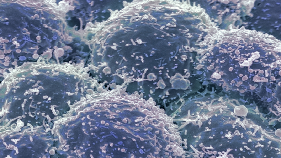 علاج تجريبي "يقمع" شكلا مميتا من سرطان الرئة لدى الفئران