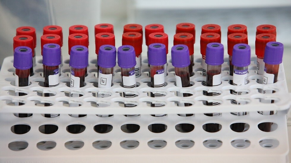 تحليل دم بطريقة جديدة يكشف معظم أنواع السرطان