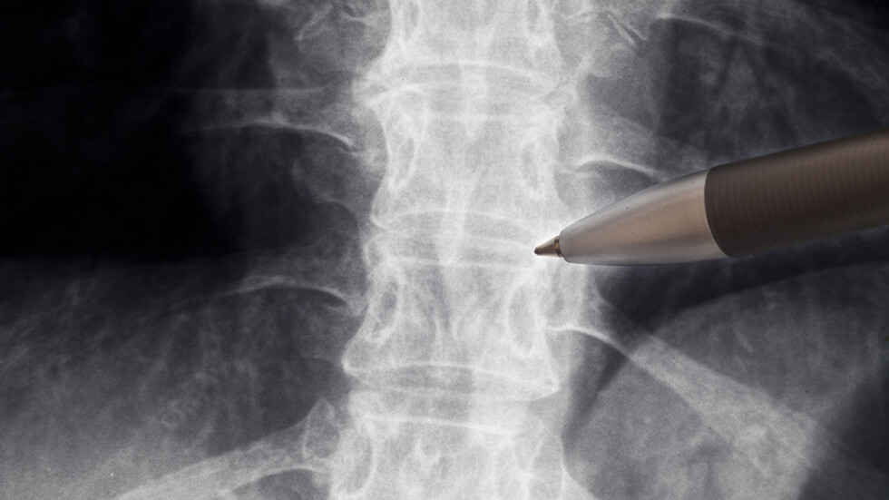 خطوة ثورية نحو علاج الشلل ..