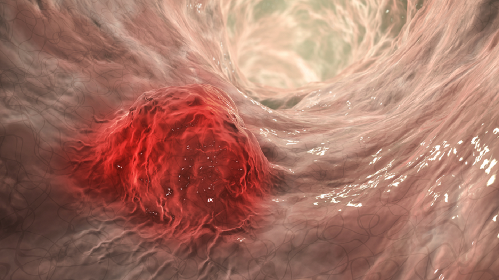 أربعة تغييرات في نمط الحياة توفر 