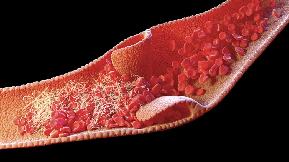 خبيرة تشير لتوابل قد تساعد في إذابة جلطات الدم