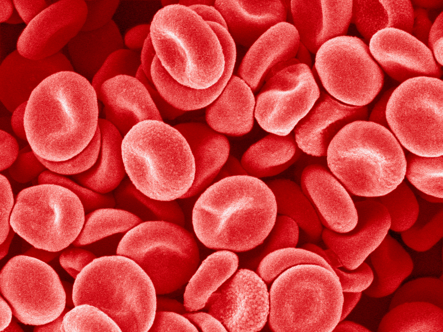 اكتشاف فصيلة دم نادرة يمكن أن تنقذ الأطفال الحديثي الولادة مستقبلا من خطر قاتل
