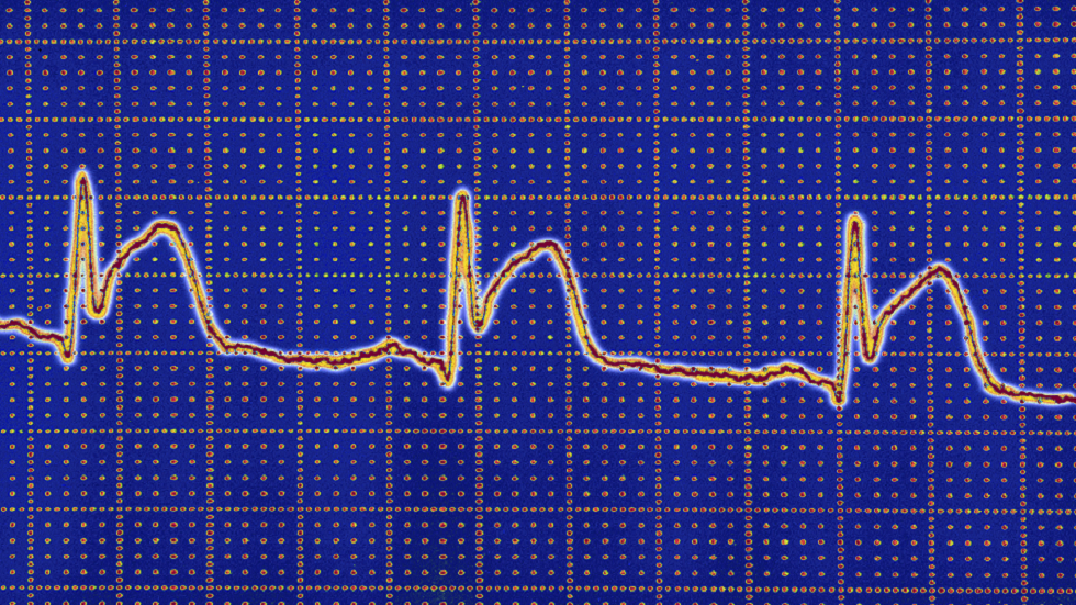 "ابتكار واعد" يمكن أن يغير طريقة دراسة وعلاج عدم انتظام ضربات القلب!